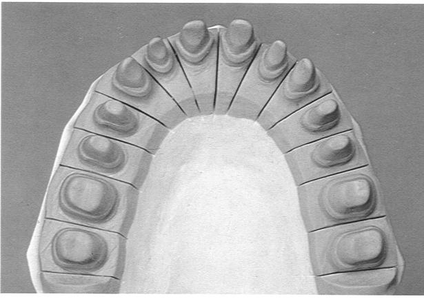 El ungüento bajo los ojos de los hinchazones y los círculos oscuros